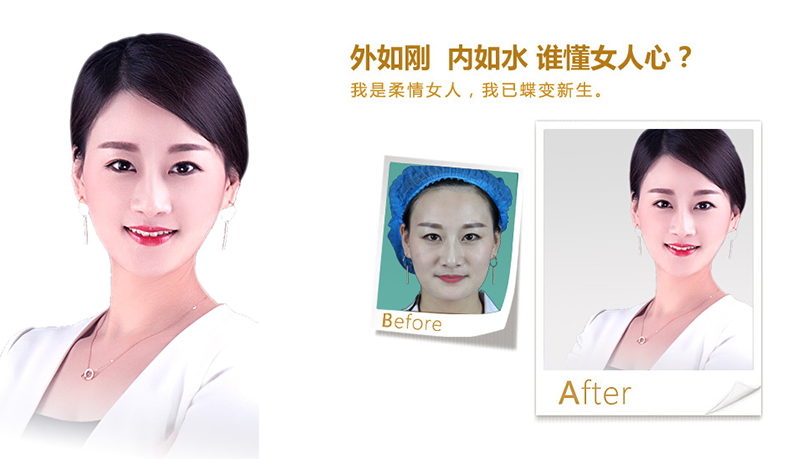 三明V脸、线雕隆鼻